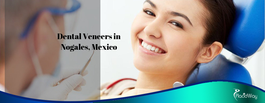 Cost of Dental Veneers in Nogales, Mexico